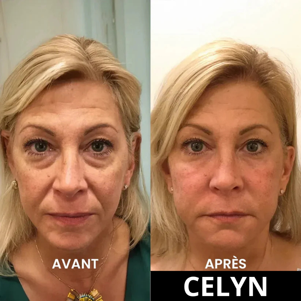 CRÈME ANTI CERNES ET RIDES INSTANTANÉE